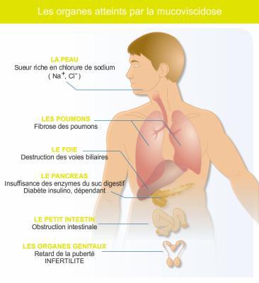 putin de maladie